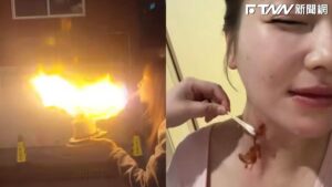 慶生變意外！中國女星模仿「噴火蛋糕」慘毀容　怒批網紅隱匿風險