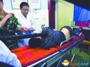 直接插入胸膛 四川男子坠楼被灯柱穿胸后奇迹生还