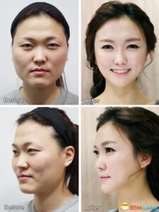 丑女跑去韩国整形成美女 回来让海关感到很为难