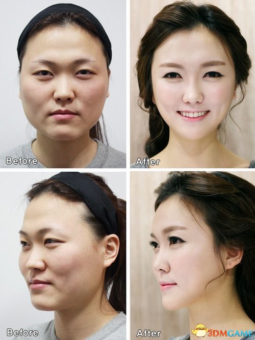 丑女跑去韩国整形成美女 回来让海关感到很为难