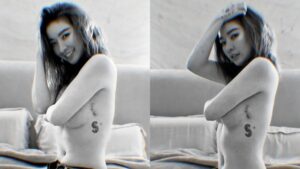 許維恩罹癌切除雙乳！親曬手術疤痕吐心聲　「是人生送給我們的勳章」